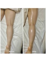 コア(Coeur)/最新マシーン★神の手ウルトラ