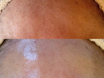 アン(An)/お肌の赤みに変化