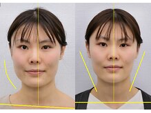 宮崎整体院/【美容整体】全身根本改善コース