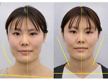 宮崎整体院/【美容整体】全身根本改善コース