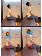 やぎはし整体院 篠籠田店/AI分析：姿勢ビフォーアフター