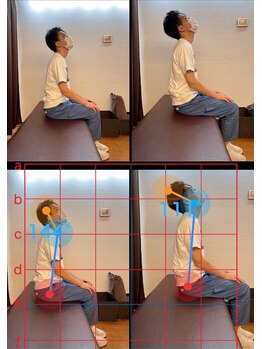 やぎはし整体院 篠籠田店/AI分析:姿勢ビフォーアフター
