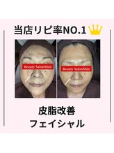 シン(Shin)/【皮脂改善フェイシャル】