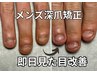 【メンズ深爪矯正】初回から見た目改善/自爪のような仕上がり￥31,900→