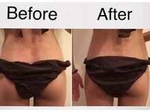 肌質改善ラボ/骨盤矯正＋ハーブピーリング