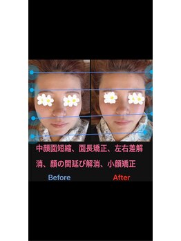 美容矯正サロン レレポノ(LELEPONO)/