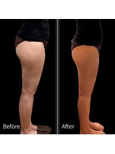 クールヴィラ(Cool Villa)/冷却4カップ×4回＋電磁パルス