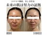 【2ヶ月の再来限定】1度で終わらせない肌改善★ポテンツアフェイシャル