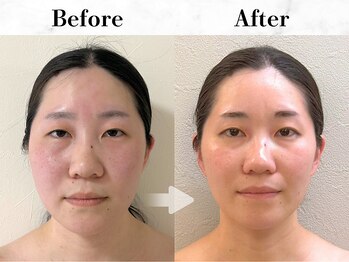 メイヴィ 四日市(Maivi)/小顔・姿勢矯正・たるみケア専門