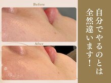 ベラノーブル(bella noble)/自分でやるのは怖かったけど、、