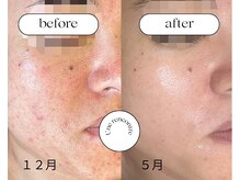 ユヌランコント 岐阜店(Une rencontre)/エンビロン