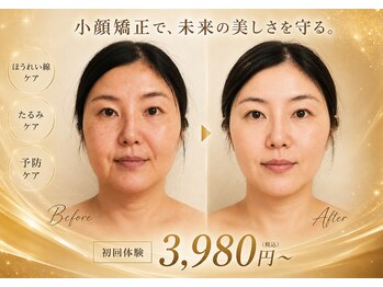 モアフェイス 池袋店(More Face)の写真/◆劇的アフター効果に自信あり◆オールハンド【頬骨フェイスライン矯正/リンパ矯正/首肩矯正】60分3980円～