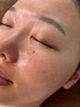 【お顔のごわつき、くすみ】ツヤ肌フェイシャルWAX(パック付き)