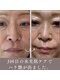 エステリワール|韓国肌管理・韓国育毛促進ケア・小顔・毛穴・脱毛・シワたるみの写真/PLLAポリ乳酸でハリ弾力潤い艶を叶える!小じわケアで輝く素肌へ導く特別な体験を☆