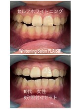プレジール(PLAISIR)/セルフホワイトニング