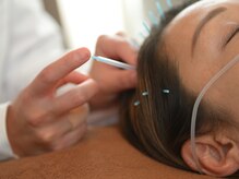 スタジオロク(studio rokh)の雰囲気(ヘッドスパ鍼!!頭痛や眼精疲労にも◎)