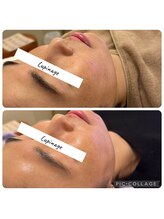 ルピナージュ(Lupinage)/小顔フェイシャル