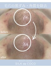 シルク ド ココ(Silk de Coco)/ハイドロ+エクストラクション