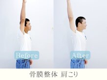 ライト 大森(HLIGHT)/ビフォーアフター