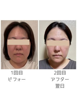 晴れ晴れ整体院/小顔になりたい方！