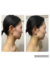 ミニマルサロン(Minimal salon)/小顔フェイシャル