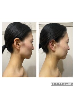 ミニマルサロン(Minimal salon)/小顔フェイシャル