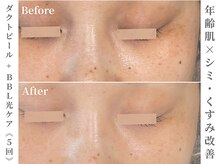 ゼアー(THERE FY.)/年齢肌も諦めない豊富なメニュー