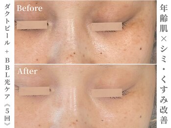 ゼアー(THERE FY.)/年齢肌も諦めない豊富なメニュー
