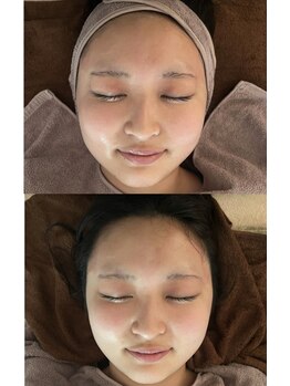 サロンリンセ(Rinse)/セラピール☆ビフォーアフター