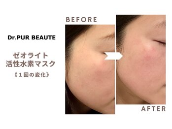 サロンソワ(salon Soi.)/ピュールボーテ：水素マスク