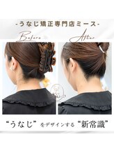 ミース 長野店/うなじ矯正◆ビフォーアフター