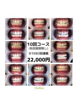 ルブラン 奈良店(Le Blanc)/15分2回連続必須の10回コース