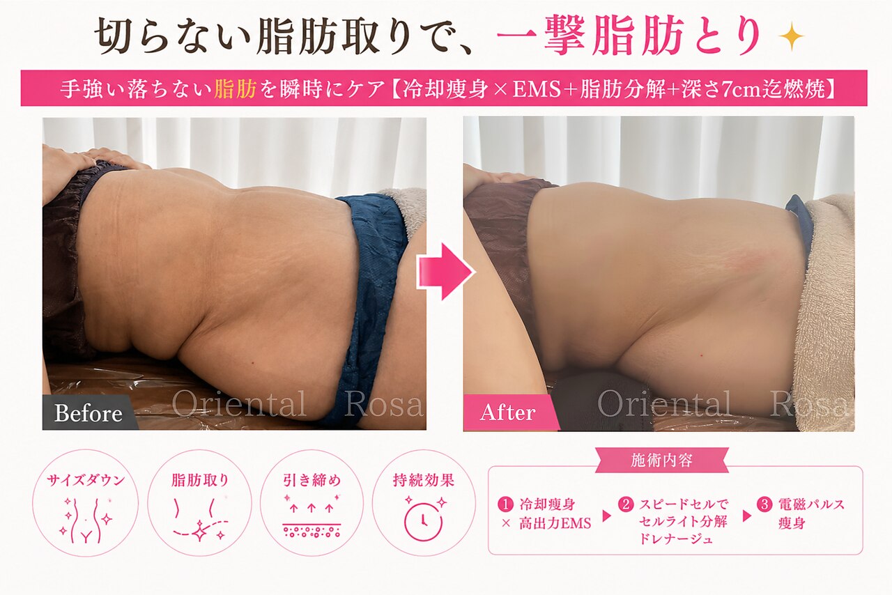 オリエンタルローザ 表参道(Oriental Rosa)｜ホットペッパービューティー