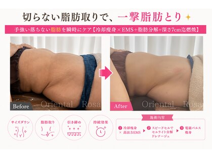 オリエンタルローザ 表参道(Oriental Rosa)の写真