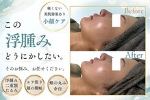モンビジュー(monbijou)
