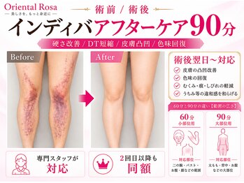 オリエンタルローザ 表参道(Oriental Rosa)/術後・きず・きずあと・色味改善