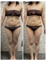 ハート ルポ(Heart)/【痩身ビフォーアフター】