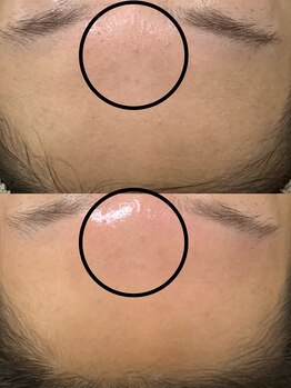 ニコ(25)/ラミピール