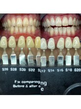 トウキョースワーズ 渋谷店(TOKYO SWRS)/#ホワイトニング #渋谷 #池袋