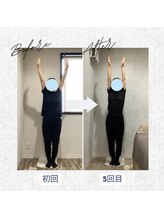 ラクリエ 東加古川院(La Creer)/お客様ビフォーアフター