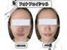 【光フェイシャル】ハリのある艶肌フルコース (60分)　¥8000