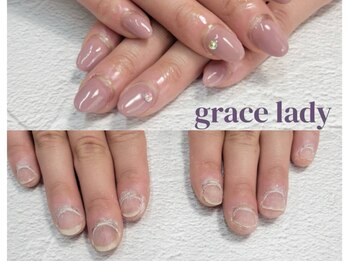 グレースレディ/矯正中デザインもできます