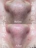 【初回限定！】フェイシャルワックス 2部位　 ¥6,000⇒5,000-