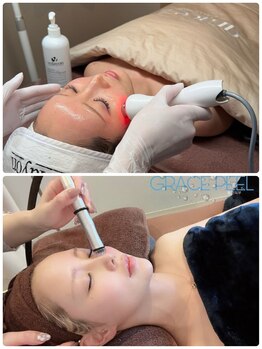 エスポワ/LDM水玉リフト&水光アクア