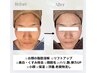【顔の脂肪燃焼×艶肌×脱毛！】金の糸脱毛＋エルフィーノ＋陶器肌パック