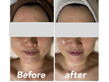 メロー(MELLOW)/リフトアップ/艶/透明感/毛穴