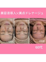 レアナ(LEANA)/60代　美容液導入×ドレナージュ