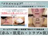 【最強プラズマ×免疫強化フェイシャル】たるみケア/トラブル肌/赤み 75分