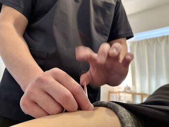 ポノ(Pono)の写真/女性鍼灸師在籍で安心！専門機関らしくない気軽に立ち寄れるプライベート空間でお悩みを徹底改善♪