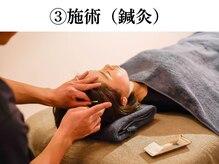 シゴウ鍼灸整体院(Shigo鍼灸整体院)/施術（鍼灸）